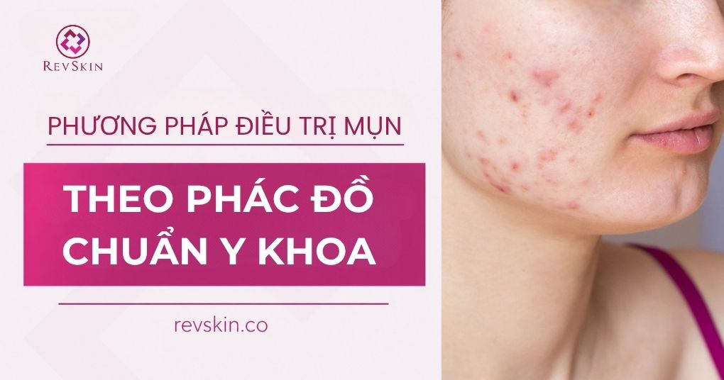 Phương pháp điều trị mụn theo phác đồ chuẩn y khoa điều trị mụn theo phác đồ chuẩn y khoa