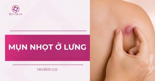 mụn nhọt ở lưng