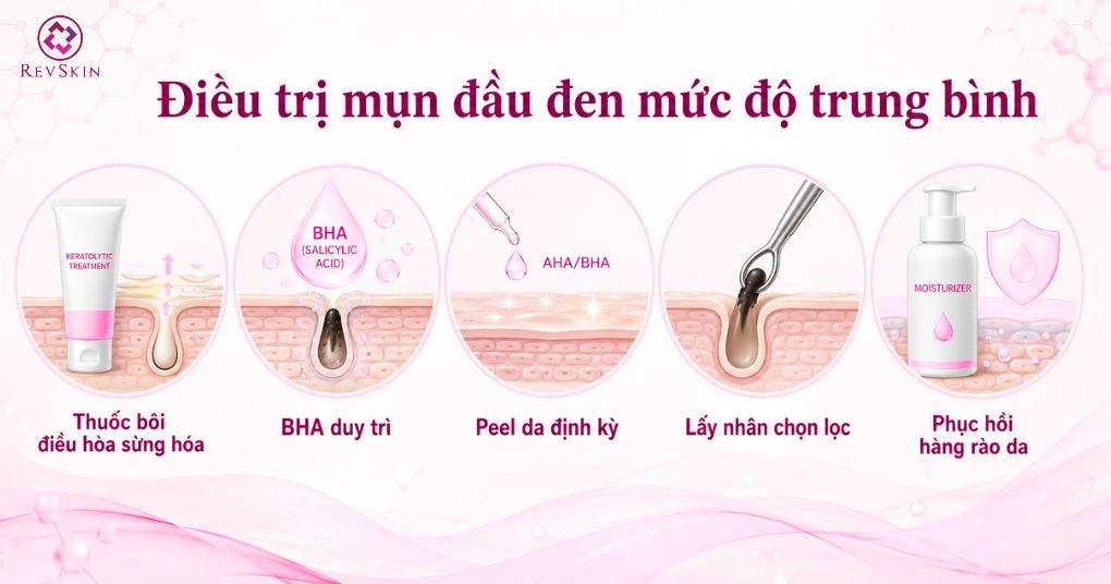 mức độ mụn đầu đen mức độ trung bình