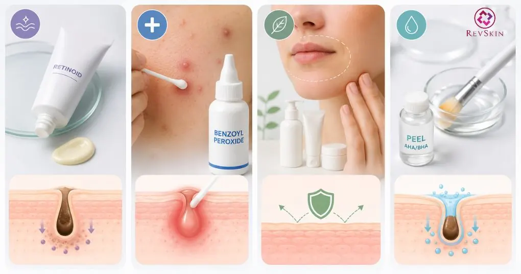 phác đồ mụn nhẹ kiểm soát bít tắc