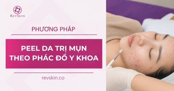 phương pháp peel da trị mụn theo phác đồ