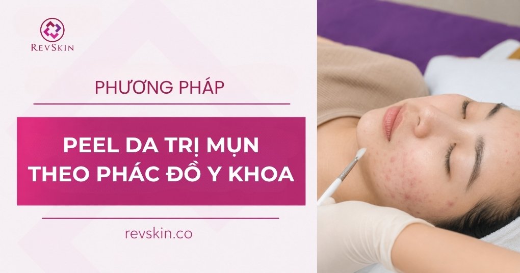 phương pháp peel da trị mụn theo phác đồ