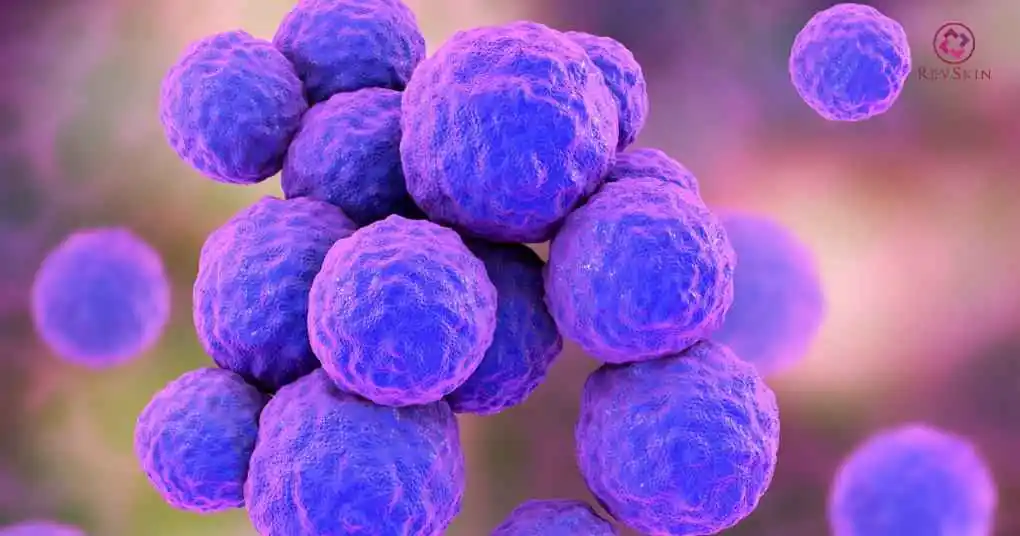 Mụn nhọt ở lưng là gì? Nguyên nhân, chẩn đoán và cách điều trị Staphylococcus aureus