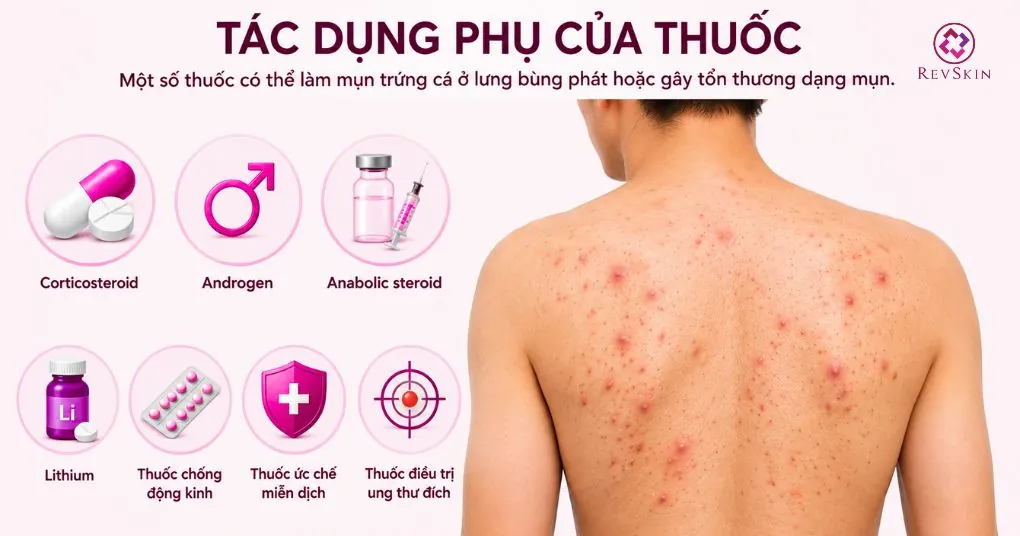 tác dụng phụ của thuốc gây mụn lưng