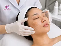 Điều trị nám