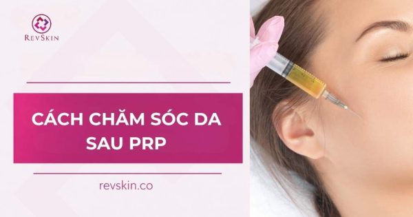 cách chăm sóc da sau prp
