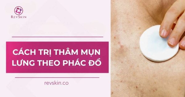cách trị thâm mụn lưng