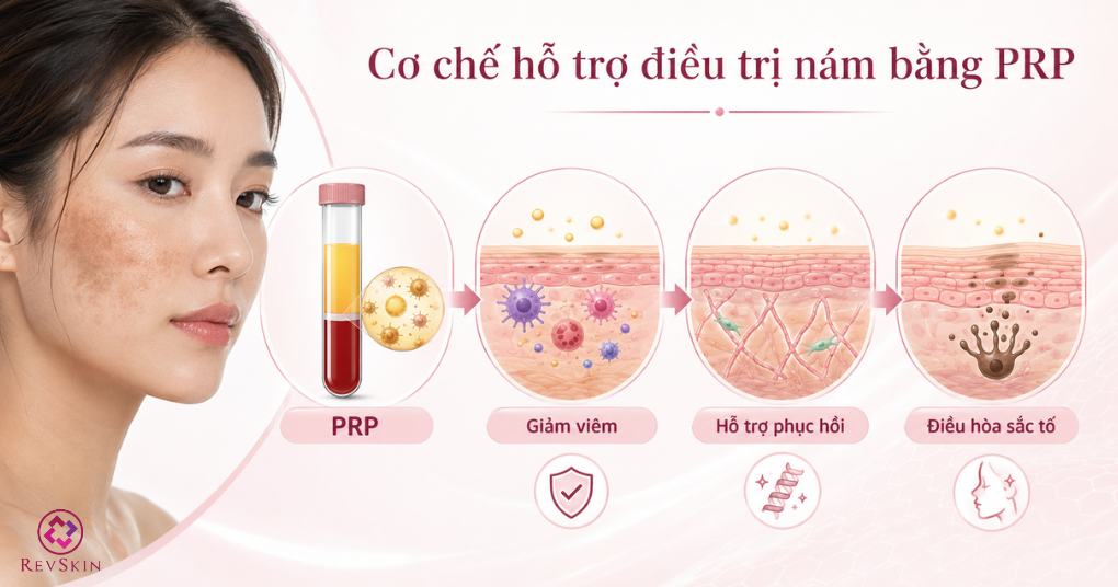 cơ chế hỗ trợ điều trị nám da bằng prp