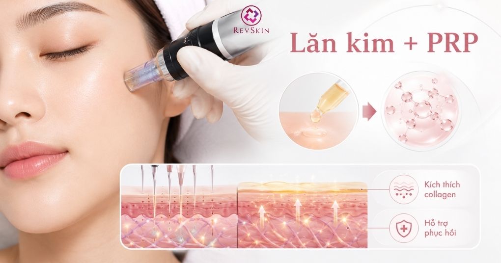 PRP là gì? Cơ chế hoạt động của huyết tương giàu tiểu cầu trong thẩm mỹ lăn kim kết hợp prp kích thích collagen
