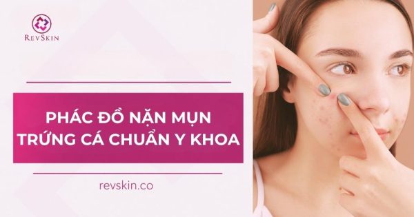 Phác đồ nặn mụn trứng cá chuẩn y khoa và biến chứng nặn mụn trứng cá