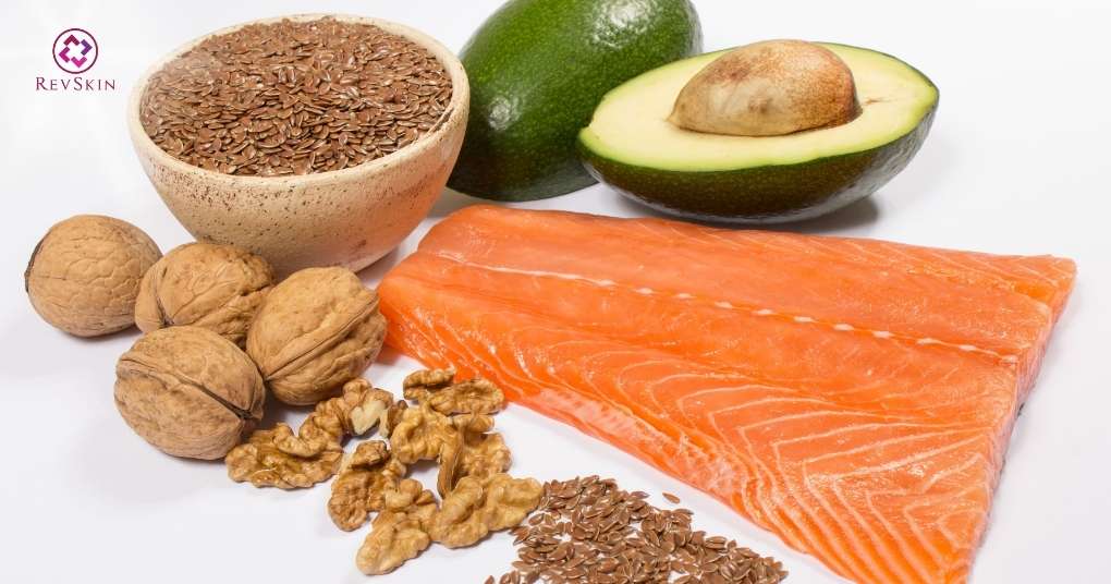 Bị mụn trứng cá kiêng ăn gì và nên ăn gì để cải thiện? omega 3 giảm viêm mụn