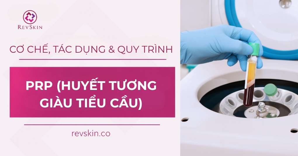 PRP là gì? Cơ chế hoạt động của huyết tương giàu tiểu cầu trong thẩm mỹ prp huyet tuong giau tieu cau