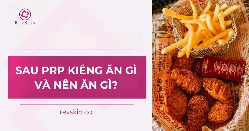 sau prp kiêng ăn gì