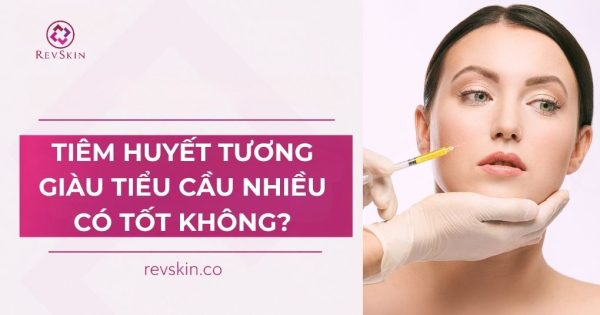 tiêm huyết tương giàu tiểu cầu nhiều có tốt không?