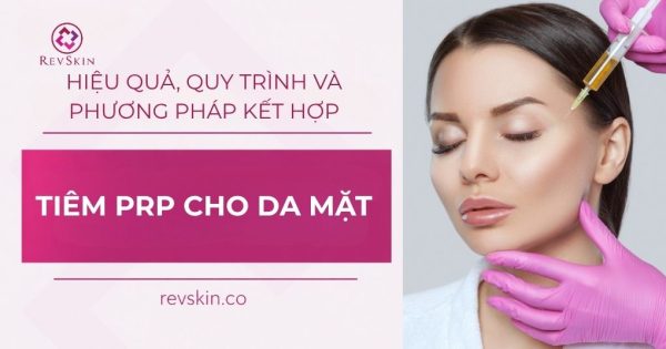tiêm prp cho da mặt