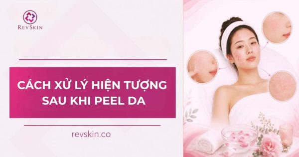 cách xử lý hiện tượng sau khi peel da