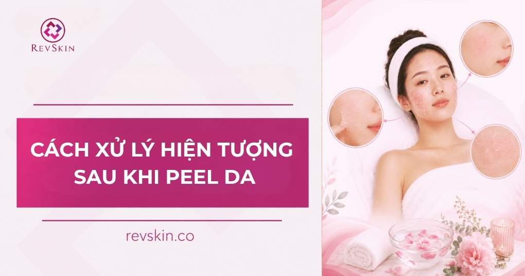 Cách xử lý các hiện tượng sau khi peel da theo chuẩn y khoa cách xử lý hiện tượng sau khi peel da