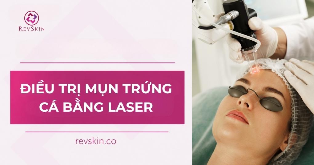 Điều trị mụn trứng cá bằng laser theo phác đồ y khoa điều trị mụn trứng cá bằng laser