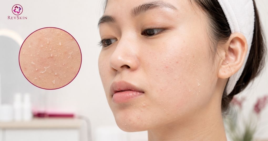 giai đoạn 1-2 tuần