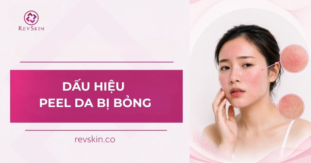 Dấu hiệu peel da bị bỏng và cách xử lý an toàn peel da bị bỏng