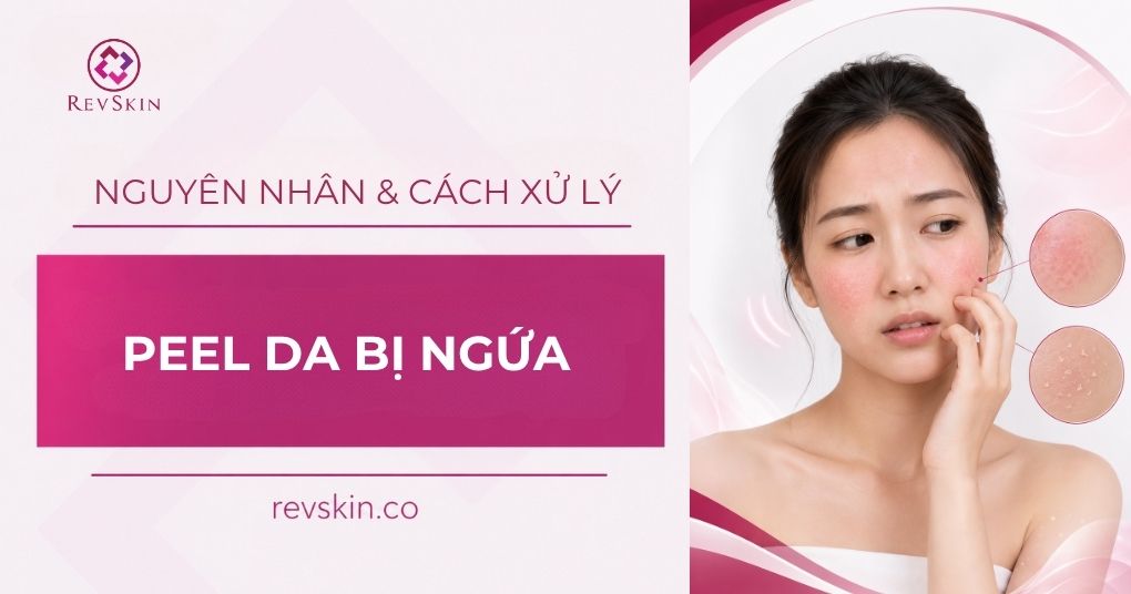 peel da bị ngứa 