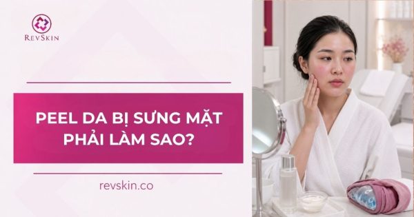 peel da bị sưng mặt phải làm sao