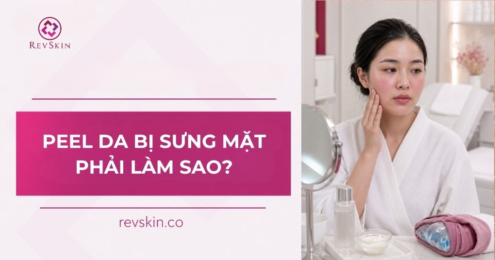 Sau khi peel da bị sưng mặt phải làm sao? Cách xử lý peel da bị sưng mặt phải làm sao