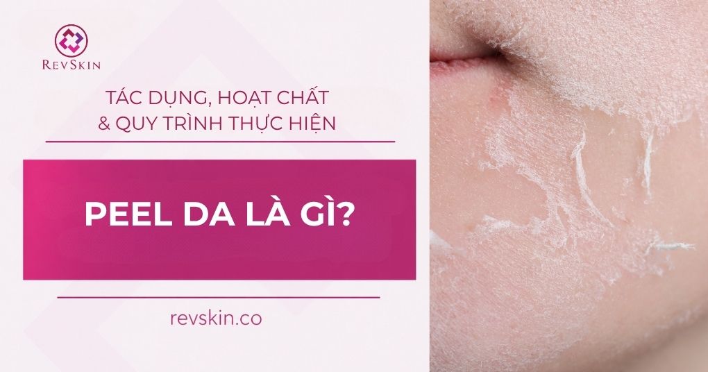 Peel da là gì? Tác dụng, phân loại, hoạt chất và quy trình thực hiện peel da là gì