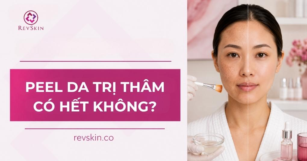 Peel da trị thâm có hết không? peel da trị thâm