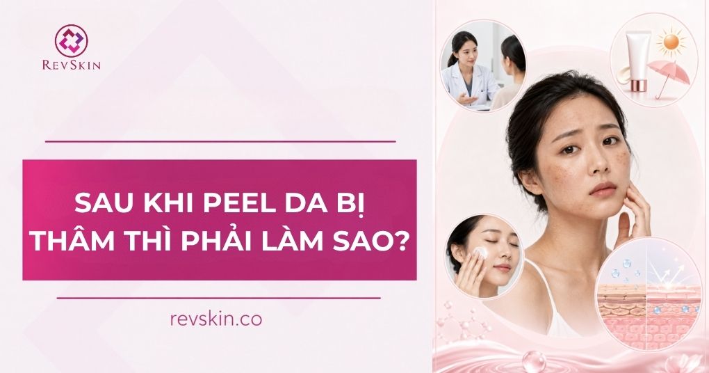 Sau khi peel da bị thâm phải làm sao? Quy trình xử lý sau khi peel da bị thâm