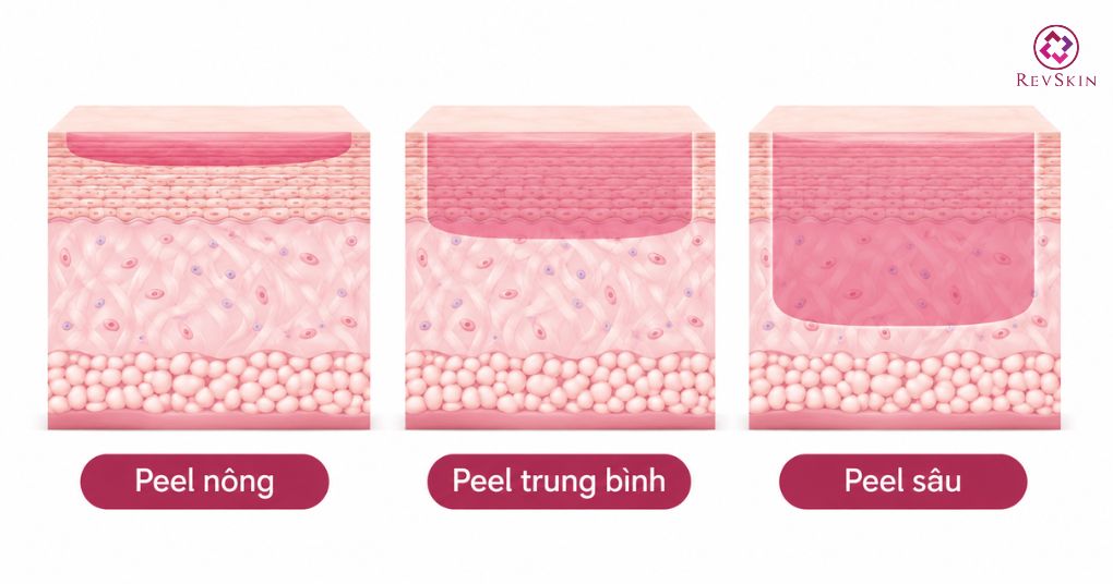 Peel da sinh học là gì? Cấp độ, quy trình và xử lý biến chứng ba cấp độ peel
