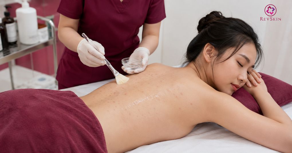 Peel lưng: Tác dụng, hoạt chất, quy trình và sai lầm cần tránh cải thiện thâm sau mụn