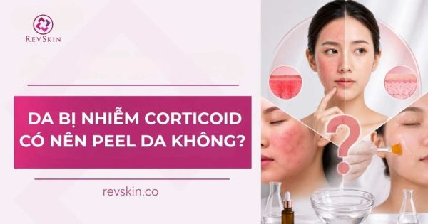 Da bị nhiễm corticoid có nên peel da không