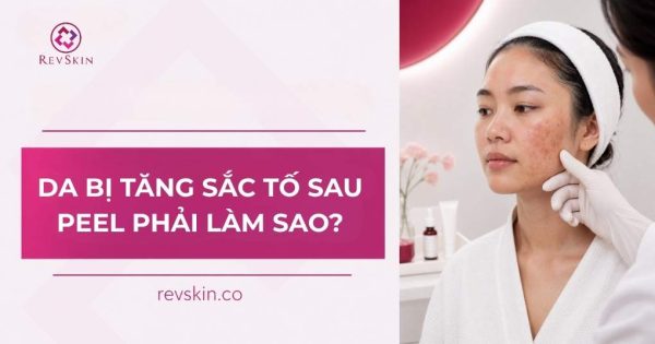 da bị tăng sắc tố sau peel