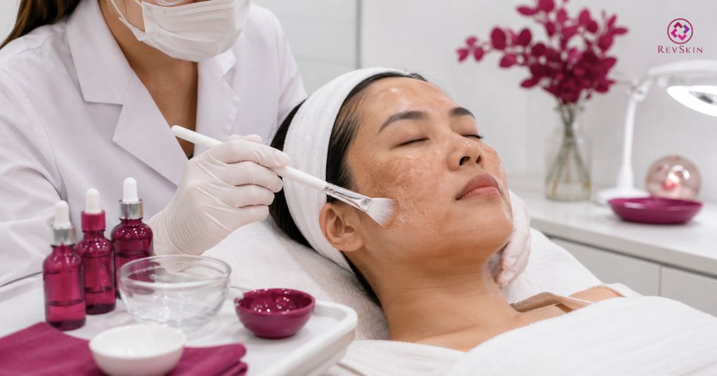 Peel da trị nám: Hoạt chất, chỉ định, quy trình và một số lưu ý kiểm soát nồng độ