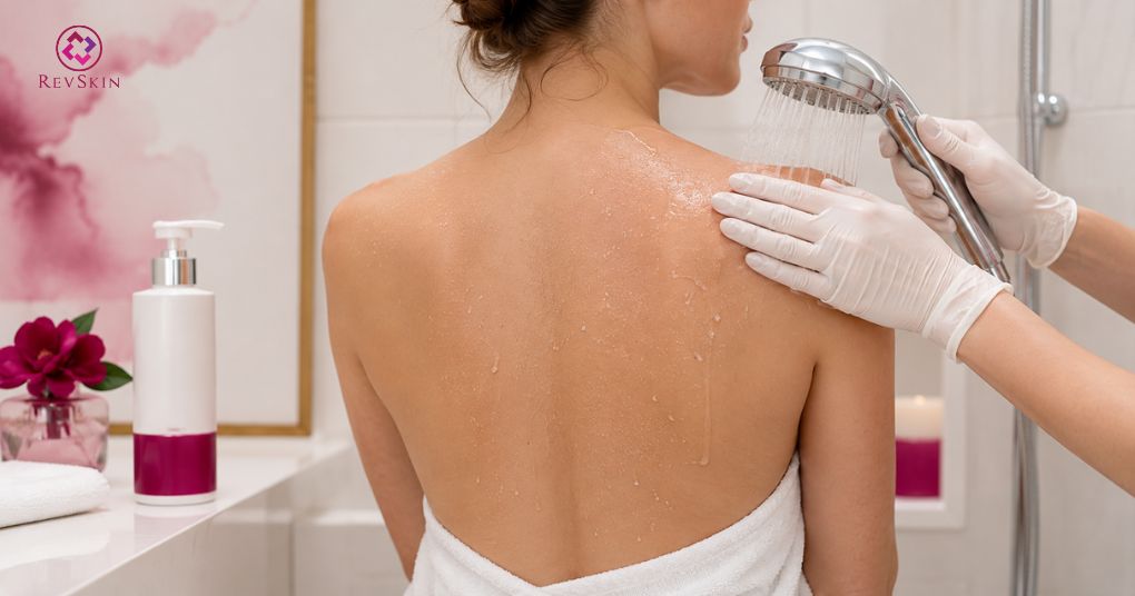 Peel lưng: Tác dụng, hoạt chất, quy trình và sai lầm cần tránh làm sạch dịu nhẹ