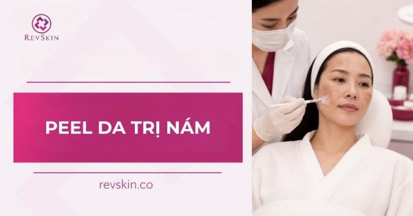 peel da trị nám