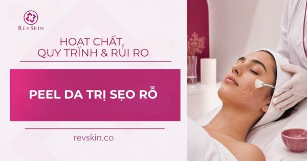 peel da trị sẹo rỗ