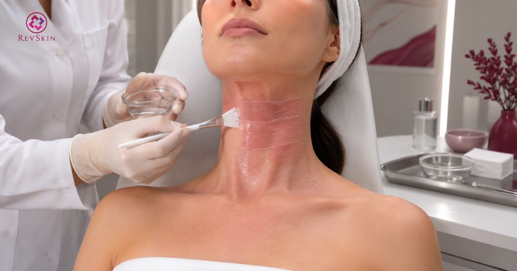 peel sâu vùng cổ