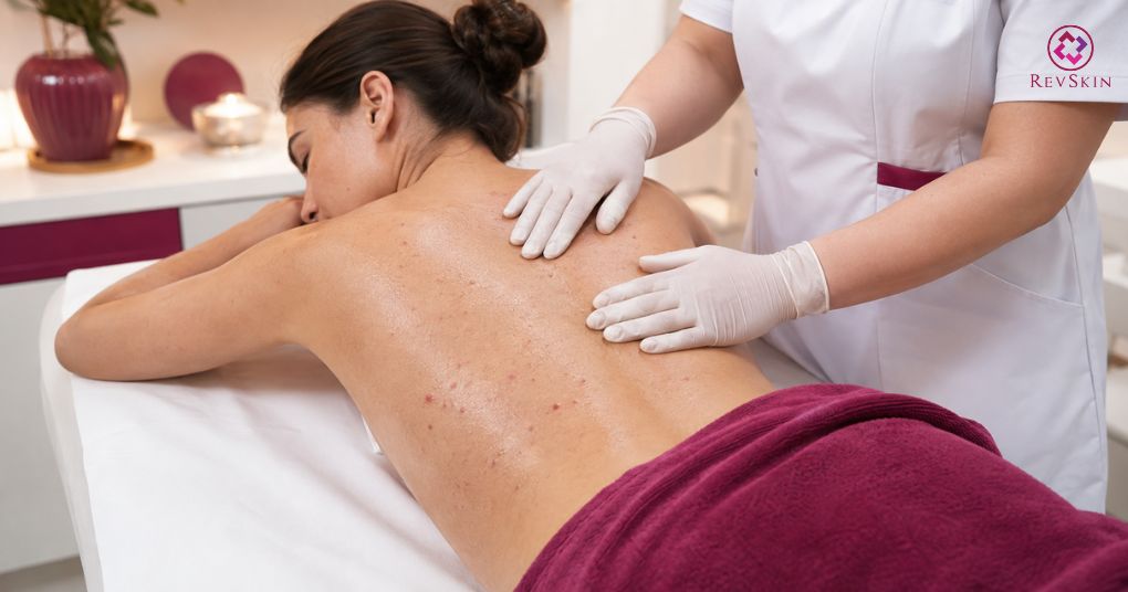 Peel lưng: Tác dụng, hoạt chất, quy trình và sai lầm cần tránh phối hợp peel lưng