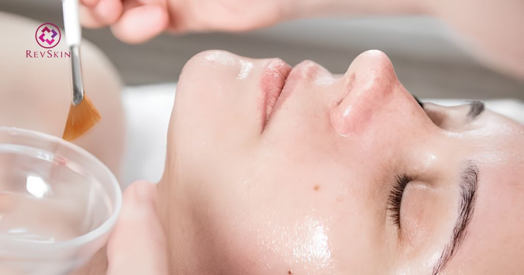 quy trình peel làm trắng da tiêu chuẩn
