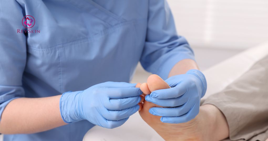 ưu điểm của phương pháp peel da chân