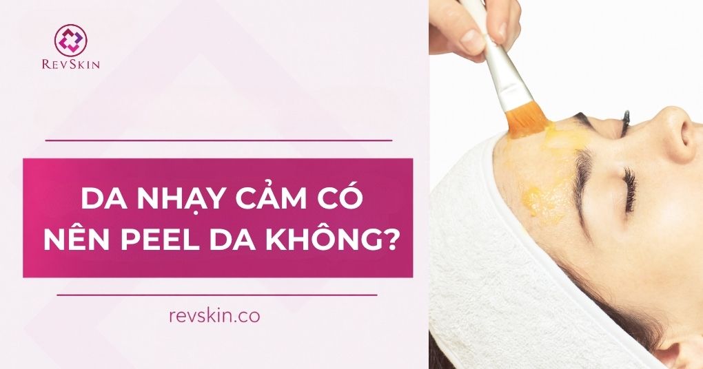 da nhạy cảm có nên peel da không
