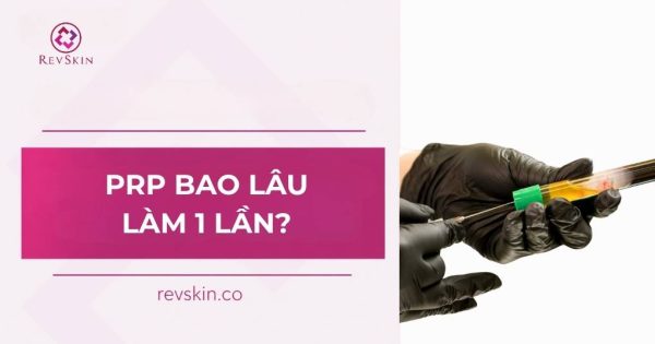 prp bao lâu làm 1 lần