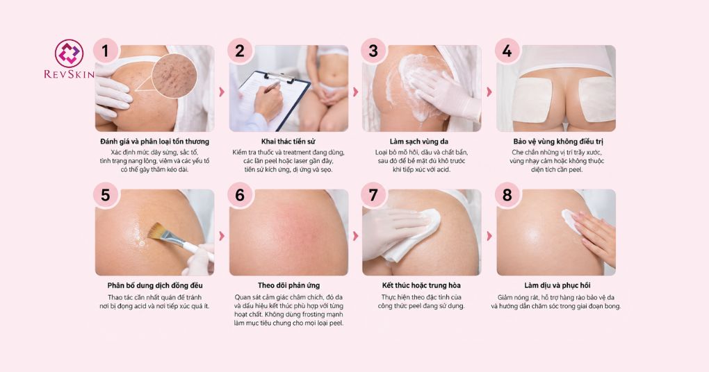 Peel mông là gì? Cơ chế, hoạt chất và quy trình chuẩn quy trình peel da mông chuẩn y khoa