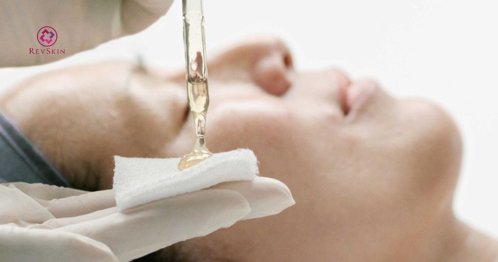 tiêu chí lựa chọn hoạt chất peel cho da nhạy cảm