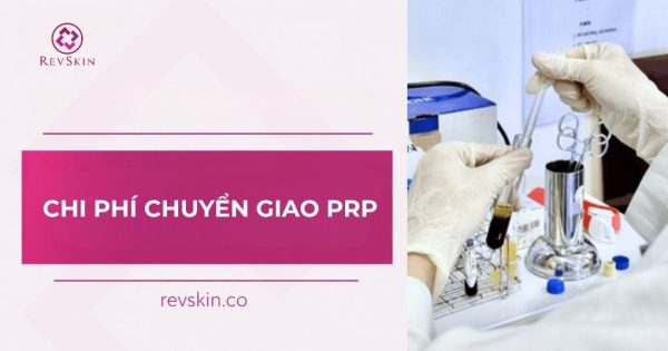 chi phí chuyển giao prp