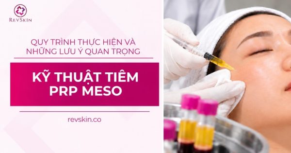 kỹ thuật tiêm prp meso