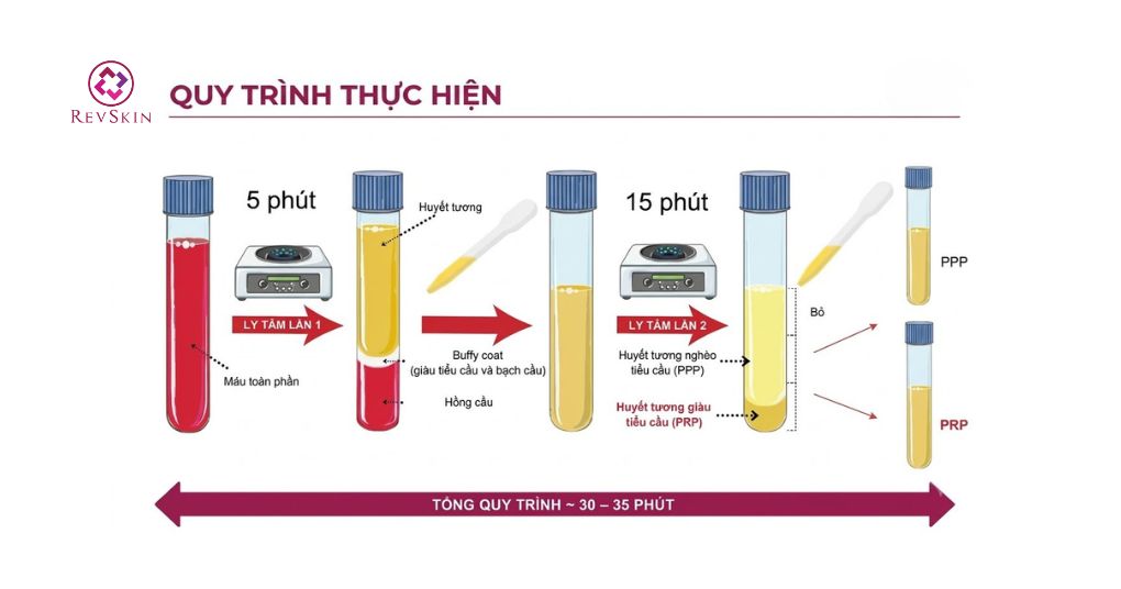 Quy trình thực hiện PRP theo tiêu chuẩn y khoa quy trình thực hiện prp theo tiêu chuẩn y khoa