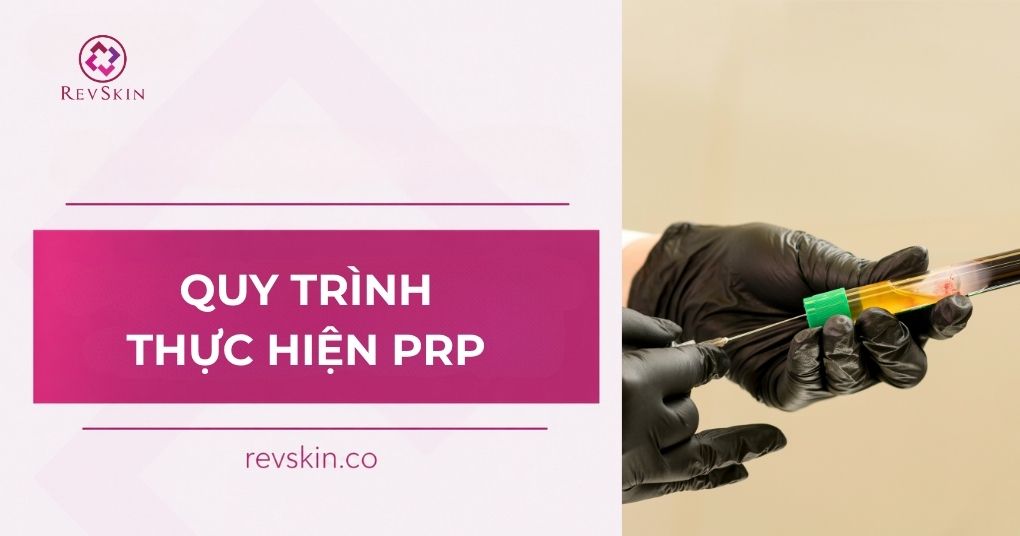 Quy trình thực hiện PRP theo tiêu chuẩn y khoa quy trình thực hiện PRP